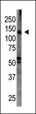 1 - BAIAP1 (MAGI1)Antibody (C-term) AP8173A