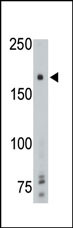 1 - PTP gamma Antibody (Center) AP8414a