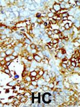 14 - Germinal Center Kinase (GCK/MAP4K2) Antibody (Center) AP7065b