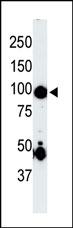 1 - Germinal Center Kinase (GCK/MAP4K2) Antibody (Center) AP7065b