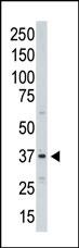 1 - Aurora-C Antibody (C-term) AP7000c