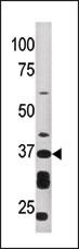 1 - ART1 Antibody (Center) AP2311c