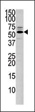 1 - PTEN Antibody (C-term) AP8436c