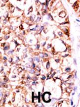 14 - PP5 Antibody (C-term) AP8476b