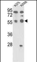 1 - PP5 Antibody (C-term) AP8476b