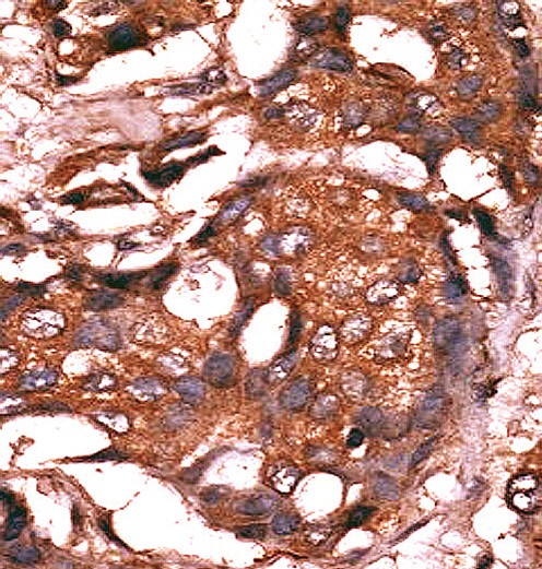 14 - Guanylyl Cyclase alpha 1 (GUCY1A3) Antibody (N-term) AP7134A