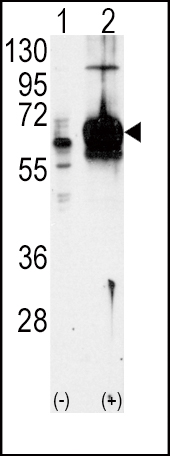1 - Guanylyl Cyclase alpha 1 (GUCY1A3) Antibody (N-term) AP7134A