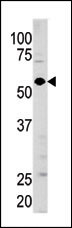 1 - Guanylyl Cyclase alpha 1 (GUCY1A3) Antibody (N-term) AP7134A