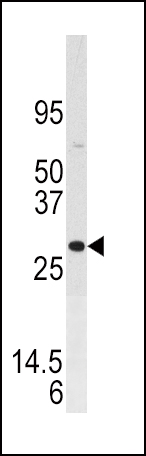 1 - DUSP3 Antibody (N-term) AP8478a