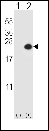 1 - DUSP3 Antibody (N-term) AP8478a