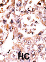 14 - DUSP3 Antibody (N-term) AP8478a