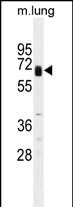 1 - Glypican 3 (GPC3) Antibody (C-term) AP6340D