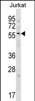 1 - Glypican 3 (GPC3) Antibody (C-term) AP6340D