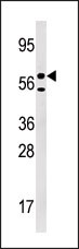 1 - URKL1 Antibody (N-term) AP7193a