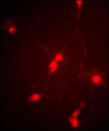 3 - CLC4 Antibody (C-term) AP6329f
