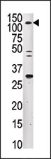 1 - ERN2 Antibody (C-term) AP7128b