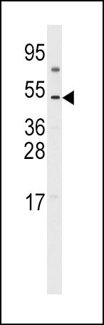 1 - VEGFD (VEGF4) Antibody (C-term) AP6292B