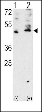 1 - VEGFC (VEGF3) Antibody (Center M263) AP2042C