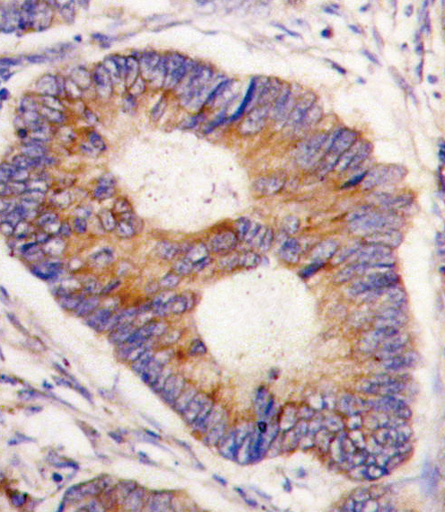 14 - FXN Antibody (Center) AP6409C