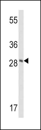 1 - FXN Antibody (Center) AP6409C