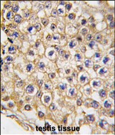 14 - Mouse TRPV3 Antibody (N-term) AP1425a