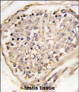 14 - NPTX2 Antibody (C-term) AP2718b