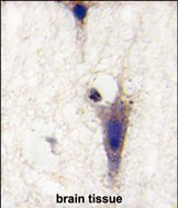 14 - LINGO1 Antibody (N-term) AP7284a