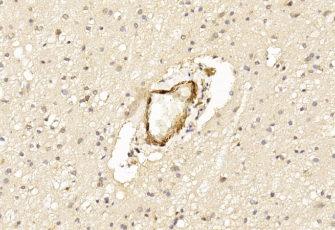 2 - LINGO1 Antibody (N-term) AP7284a