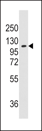 1 - AlaRS (AARS) Antibody (N-term) AP7558a