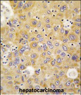 14 - AlaRS (AARS) Antibody (N-term) AP7558a