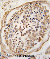 14 - NPTX2 Antibody (Center) AP2718c