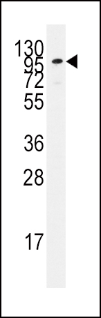 1 - ADCY2 Antibody (C-term) AP2748b