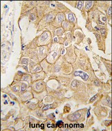 14 - ADCY2 Antibody (C-term) AP2748b