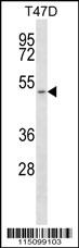 1 - MCT1 (SLC16A1) Antibody (C-term) AP2753b
