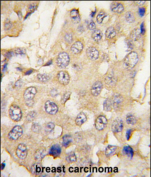 14 - Parg Antibody (N-term) AP7283a
