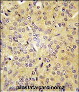 14 - LARS Antibody (C-term) AP7413b