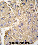 14 - PTPN7 Antibody (S44) AP7599a