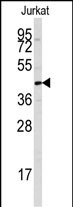 1 - PTPN7 Antibody (S44) AP7599a