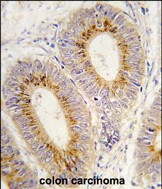 14 - Methionyl tRNA Synthetase Antibody (C-term) AP7841b