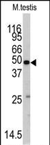 1 - Methionyl tRNA Synthetase Antibody (C-term) AP7841b