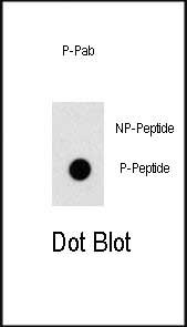 6 - Phospho-OSR1(T310) Antibody AP3576a