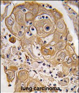 14 - PTRF Antibody (N-term) AP7421a