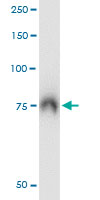 5 - ABCF2 Antibody (monoclonal) (M01) AT1010a