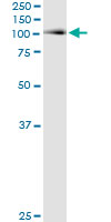 5 - ACO1 Antibody (monoclonal) (M01) AT1026a