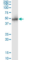 5 - ADRM1 Antibody (monoclonal) (M01) AT1060a