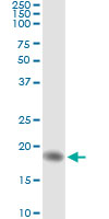 5 - AHNAK Antibody (monoclonal) (M01) AT1072a