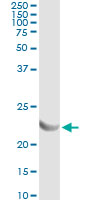 5 - AK1 Antibody (monoclonal) (M06) AT1080a