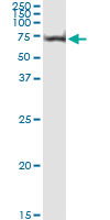 5 - AKT1 Antibody (monoclonal) (M03) AT1097a