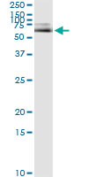 5 - ALB Antibody (monoclonal) (M01) AT1109a