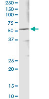 5 - ALDH3A1 Antibody (monoclonal) (M08) AT1112a